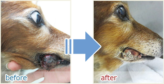 治療例メラノーマ